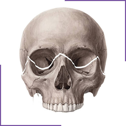 Adult Facial Fracture